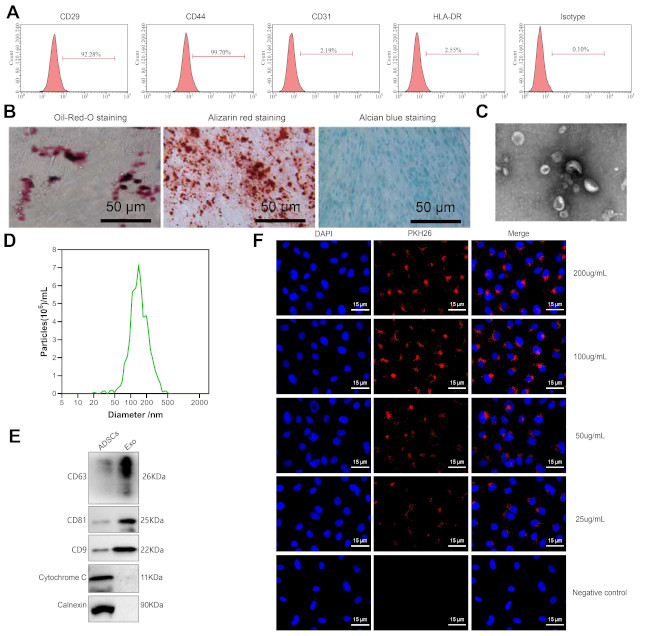 SJ5-CD4081BM